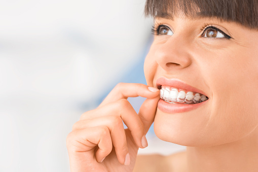 Smiling woman putting on clear aligner at Roane Family Dental in West Linn, OR 