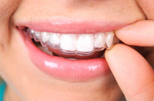 Woman using clear aligner in West Linn, OR at Roane Family Dental.