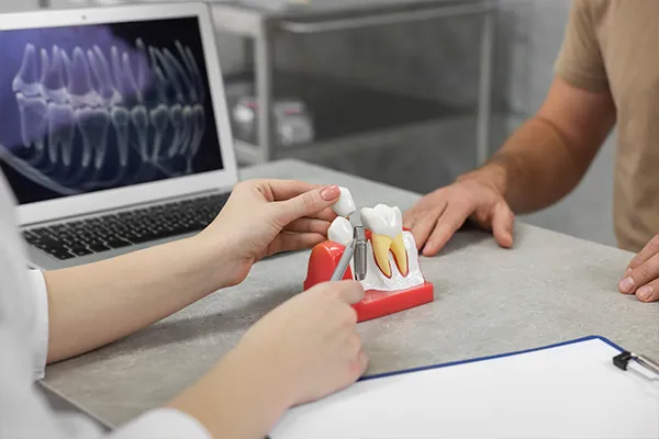 A dentist using a dental implant model to explain the procedure to a patient at Roane Family Dental in West Linn, OR
