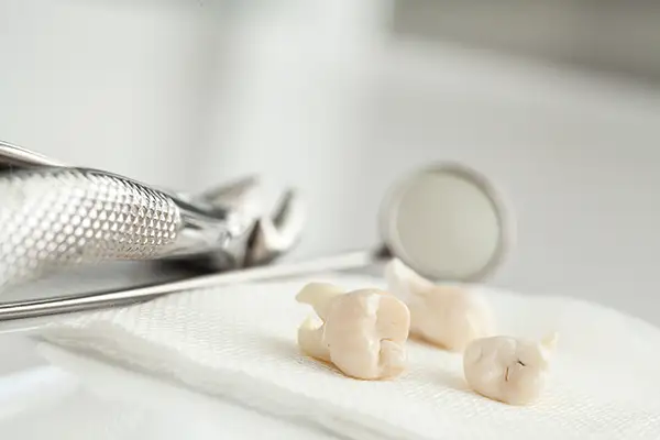 Close-up of three extracted wisdom teeth placed on a napkin with dental tools in the background.